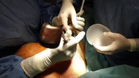 Remplacement d'une prothèse mammaire défectueuse dans une clinique à Nice. L'instruction judiciaire sur les prothèses mammaires défectueuses de la société française Poly Implant Prothèse (PIP), au coeur d'un vaste scandale en France et à l'étranger, pourr