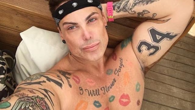 Neven Ciganovic a subi une troisième rhinoplastie.