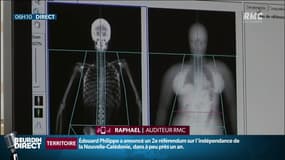 "C’est une délivrance": le témoignage de Raphaël, qui a perdu 50kg après une chirurgie de l’obésité