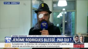 Le gilet jaune Jérôme Rodrigues affirme que sa blessure à l’œil a été causée par "un impact et non pas des éclats de grenade"