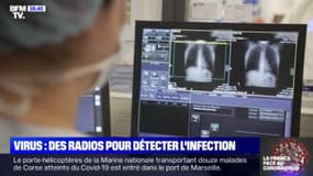 Au CHU de Strasbourg, l'unité radiologie procède à des tests au Covid-19 grâce à ses scanners