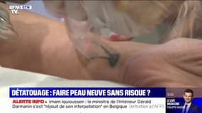 Détatouage: faire peau neuve sans risque? 