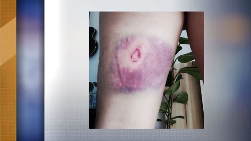 La blessure d'un journaliste par des forces de l'ordre en marge d'une mobilisation des gilets jaunes 