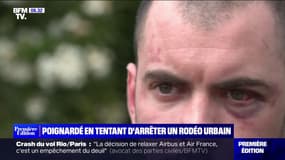 "Ils se sont jetés sur moi et m'ont roué de coups": poignardé en tentant d'arrêter un rodéo urbain, il témoigne