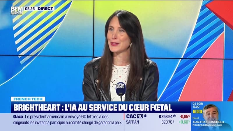 French Tech : BrightHeart, l'écographie prénatale par IA - 19/01