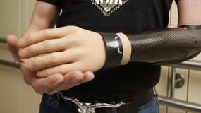 Markus Kemeter, un patient autrichien, montre sa main bionique
