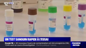 Covid-19: un nouveau test sanguin à l'étude pour quantifier l'infection