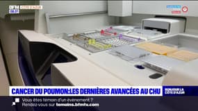 Cancer du poumon: retour sur les dernières avancées du CHU de Nice