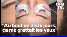 Allergies, démangeaisons: des ophtalmologues alertent sur la pose d’extensions de cils mal réalisées 