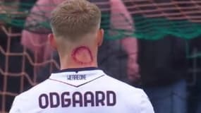 La "morsure" de Jens Odgaard lors de Venise-Bologne (0-1, Serie A), le 30 mars 2025
