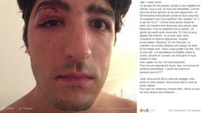 Victime d'une agression homophobe, Arnaud Gagnoud écope de sept points de suture et de plusieurs jours d'ITT.