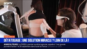 Le détatouage est-il une solution miracle ?