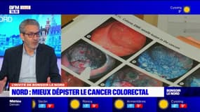 Nord: comment mieux dépister le cancer colorectal