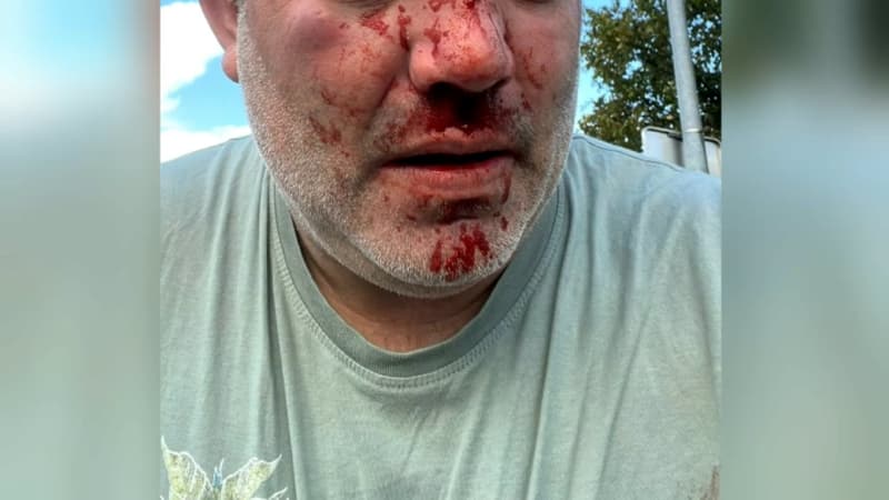 "On est le défouloir de la France": le policier violemment agressé par des mineurs à Tourcoing sort du silence