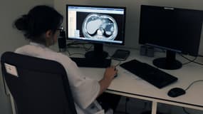 Un docteur travaille sur une radio de poumons à L'institut Universitaire du Cancer de Toulouse, le 4 juin 2015