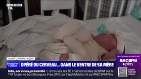 Le choix de Marie : Opéré du cerveau... dans le ventre de sa mère - 09/05