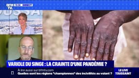 Variole du singe: la crainte d'une pandémie ?