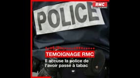 TEMOIGNAGE RMC - Arthur, 23 ans, accuse la police de l'avoir passé à tabac: "J'ai vu le coup de matraque partir et m'atteindre en pleine bouche"  