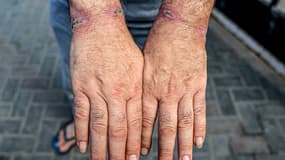 Un Palestinien détenu par l'armée israélienne montre ses poignets blessés, le 24 décembre 2023