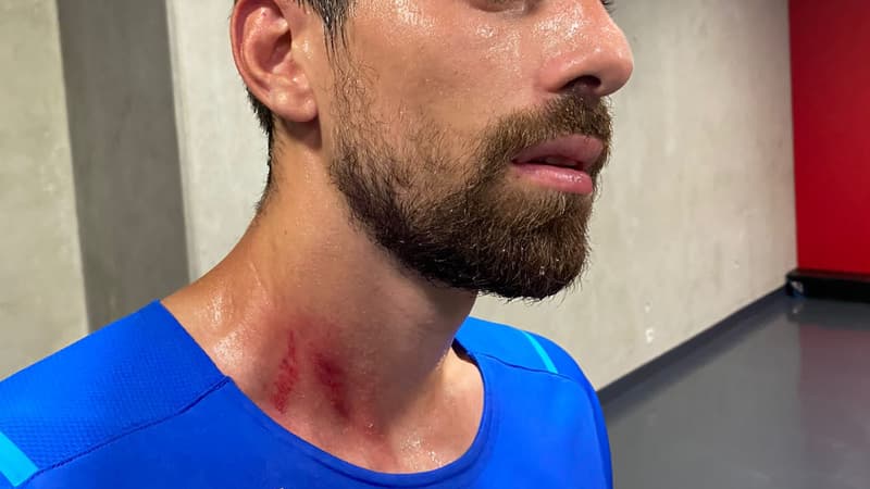 Incidents Nice-OM: les images des joueurs marseillais blessés lors de l'envahissement de terrain