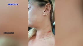 Les riverains de la place Mottet à Grasse vivent un véritable enfer à cause d'une voisine menaçante et violente au quotidien. 