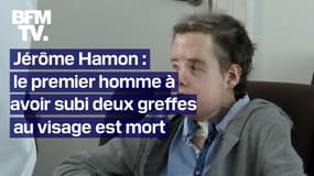 Jérôme Hamon, le premier homme avec deux greffes au visage est mort