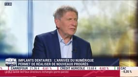 Les nouveaux progrès en matière d'implantologie dentaire grâce au numérique – 27/04