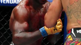 Le visage complètement tuméfié de Khalil Rountree lors de son combat face à Alex Pereira, ce samedi, pour l'UFC 307