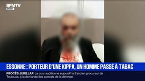 Un homme de 67 ans victime d'une violente agression antisémite dans l'Essonne