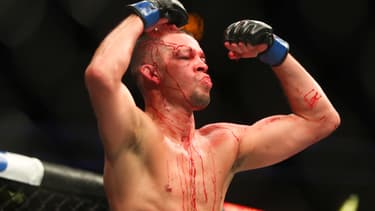 Nate Diaz
