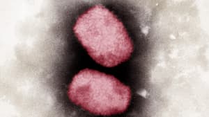 A microscopic photograph of the monkeypox virus.