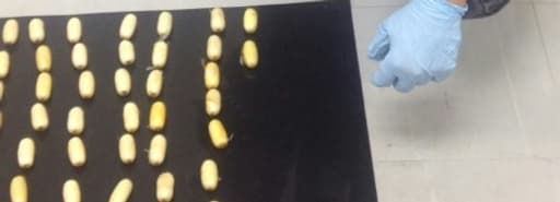 Une photo fournie par la police thaïlandaise de capsules de cocaïne retrouvées dans le ventre d'une Ivoirienne à Pkhuket, en Thaïlande, le 29 décembre 2017. 