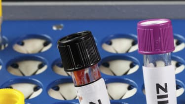 Actuellement il n’existe pas de vaccin pour prévenir l'infection par le virus Zika, ni de médicament spécifique pour soigner la maladie.