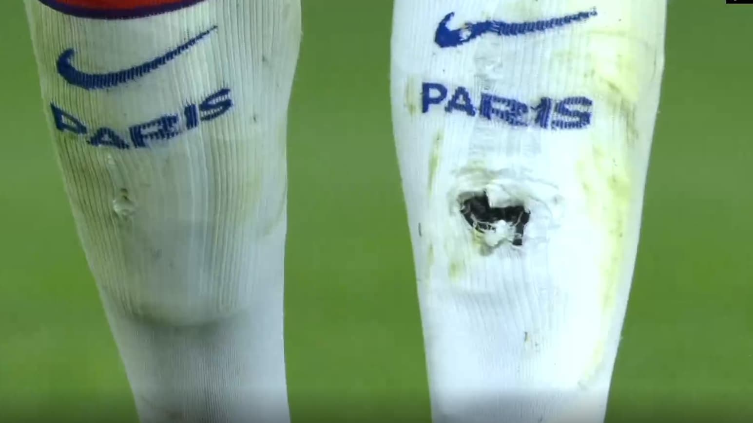 La chaussette de Kurzawa après le tacle d'Aguerd La chaussette de Kurzawa après le tacle d'Aguerd