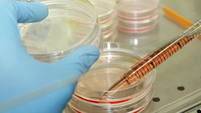 Les députés français ont repris mercredi l'examen d'une proposition de loi qui prévoit d'autoriser sous certaines conditions la recherche sur l'embryon et les cellules souches embryonnaires, malgré la vive opposition de la droite. /Photo d'archives/REUTER