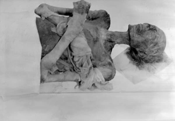 Photo prise le 12 novembre 1976 au musée de l'Homme à Paris de la momie du pharaon Ramsès II, arrivée en septembre 1976 afin de subir un traitement d'assainissement. 
