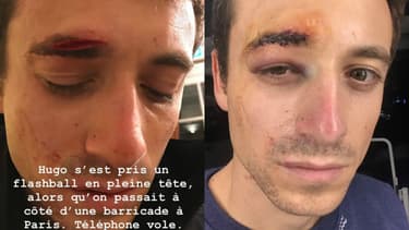 Hugo Clément a été blessé à Paris lors des manifestations.