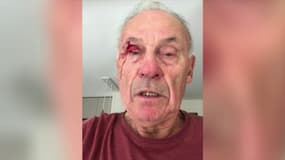 Bernard Dupré, victime d'une agression le 4 juillet lorsqu'il collait des affiches en Isère. 