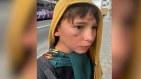 Jean, 11 ans, victime de coups lors d'une colonie de vacances en Bretagne, août 2024 