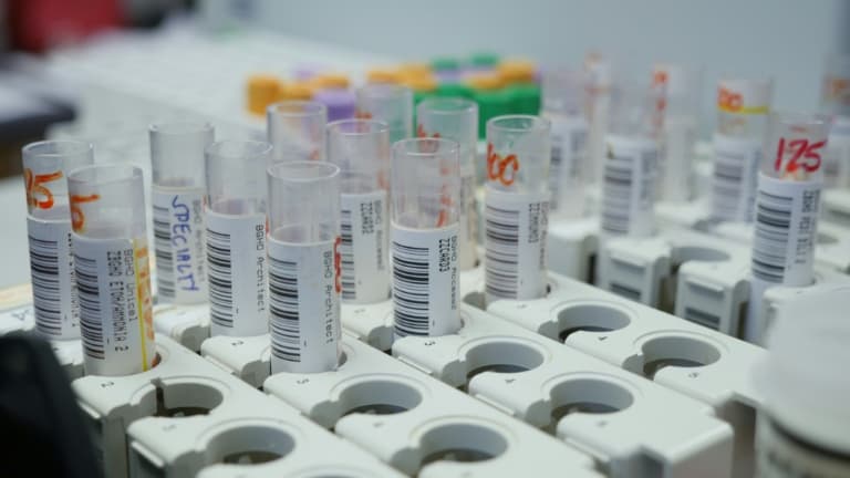 L'innovation ne vient plus en effet "des 'big pharmas', qui recherchent de plus en plus des innovations en externe, mais des start-up financées par du capital-risque".