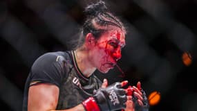 L'impressionnante blessure au visage d'Irene Aldana lors de sa défaite contre Norma Dumont à l'UFC 306, le 14 septembre 2024