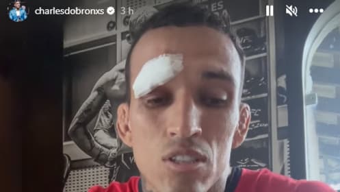 La story de Charles Oliveira pour annoncer son forfait à l'UFC 294, 11 octobre 2023