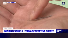 Implant Essure : quatre Lyonnaises portent plainte