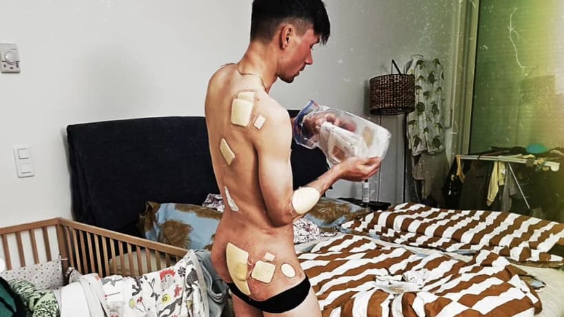 Primoz Roglic poste une photo de ses blessures après le Tour du Pays basque, 7 avril 2024