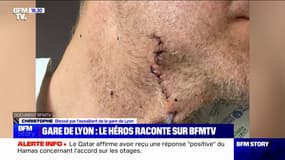 "J'avais l'impression que le couteau ne s'enfonçait pas dans ma peau": Le témoignage de Christophe, blessé par l'assaillant de la Gare de Lyon samedi