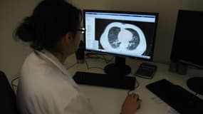 Le nouveau test lancé par le CHU de Nimes pourra permettre de détecter le cancer avant les techniques classiques d'imagerie.