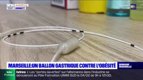 Marseille: un ballon gastrique innovant pour lutter contre l'obésité