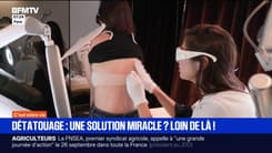 Le détatouage est-il une solution miracle ?