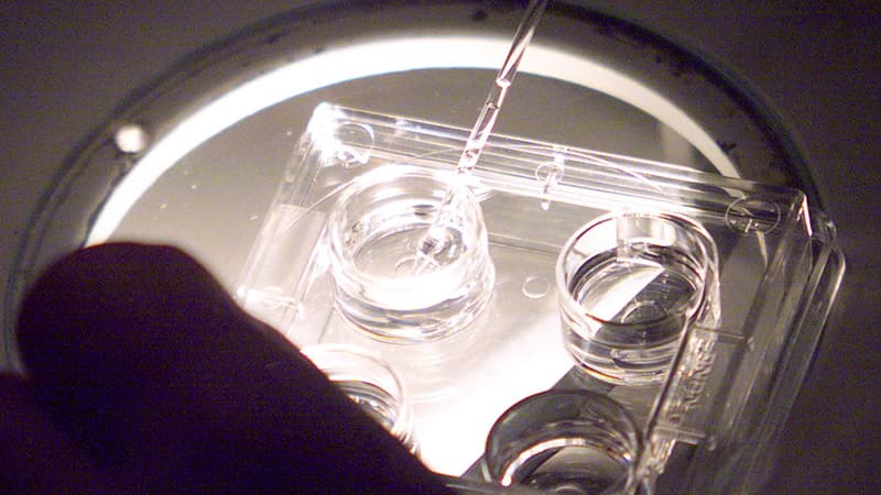 Préparation des ovocytes sous hotte stérile avant la micro-injection des spermatozoïdes dans les ovocytes, le 30 novembre 2000 au C.E.C.O.S (Centre d'étude et de conservation du sperme humain) de Rennes. Photo d'illustration.