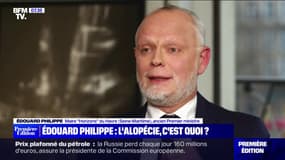 Édouard Philippe atteint d'alopécie, une maladie méconnue et mal prise en charge selon les personnes atteintes